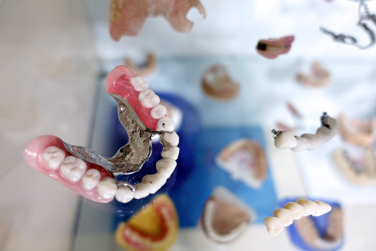 The Difference Between Dental Implants, Bridges and Partial Dentures