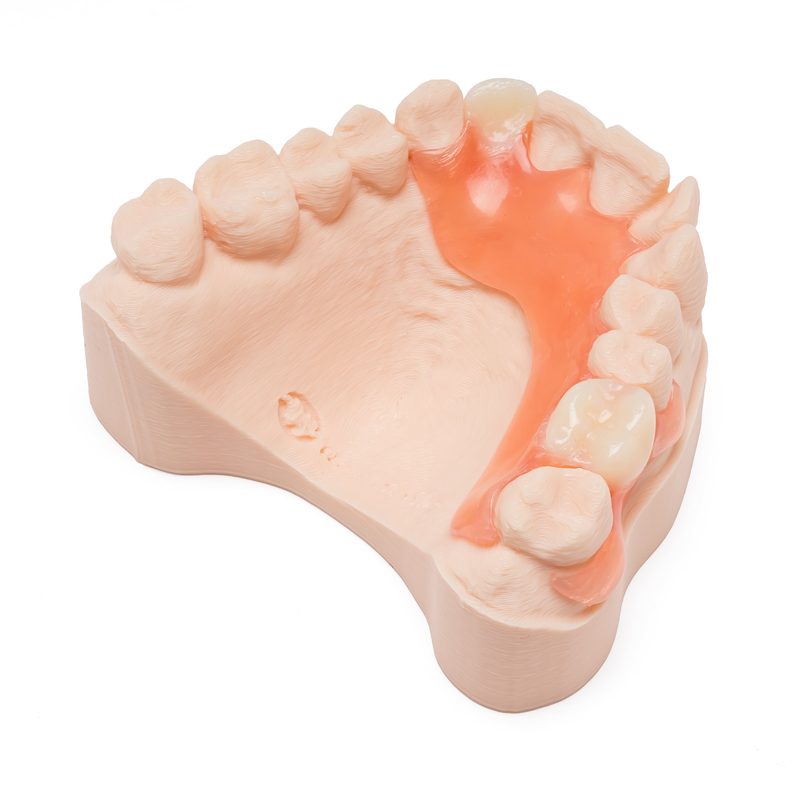 One Arch Upper Flexible Partial Denture