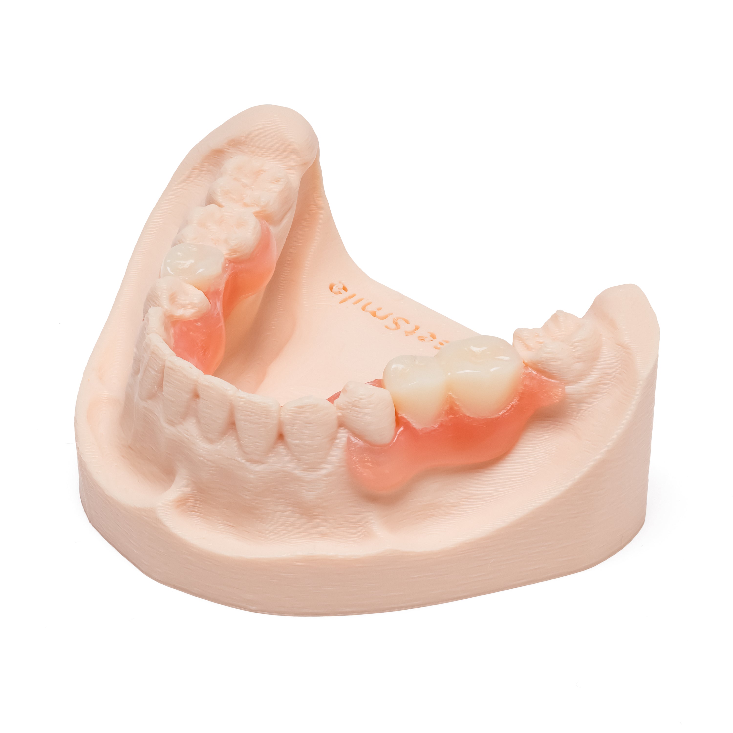 One Arch Lower Flexible Partial Denture