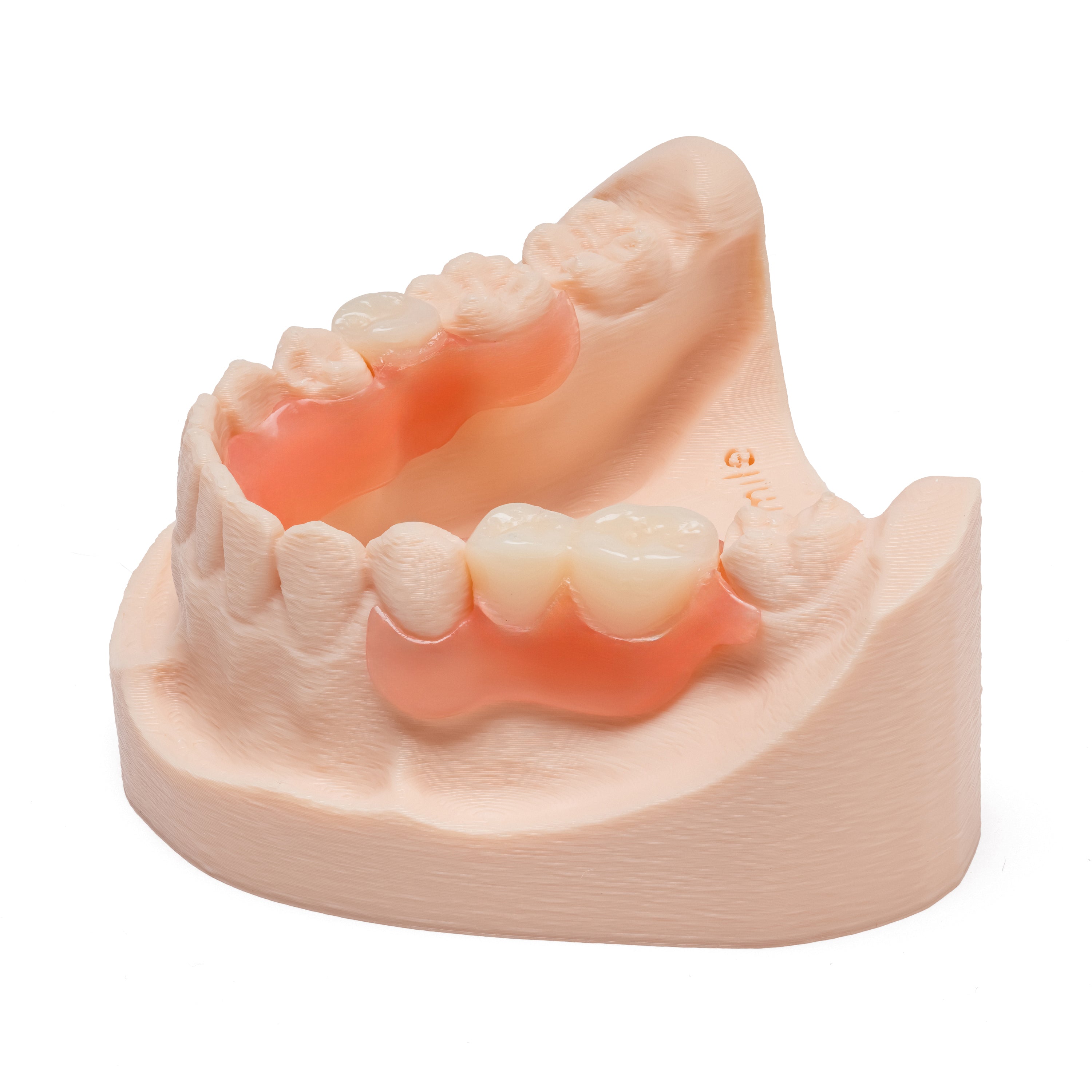 One Arch Lower Flexible Partial Denture