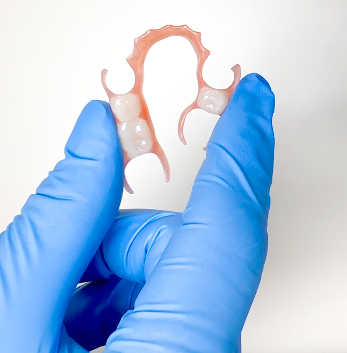 One Arch Lower Flexible Partial Denture